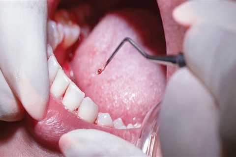 Periodontics: Common Treatments and Procedures