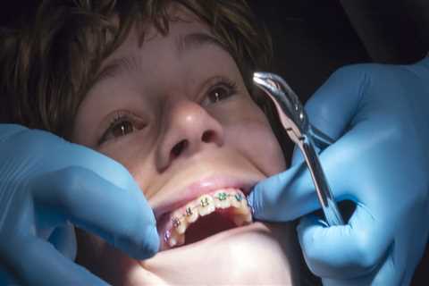 Do I Need to Take a Test to Maintain My Orthodontist Certification?