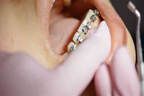 Discover The Importance Of Endodontics: Unveiling The Secrets To A Healthy Smile