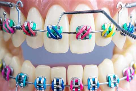 What are the different orthodontic treatments?