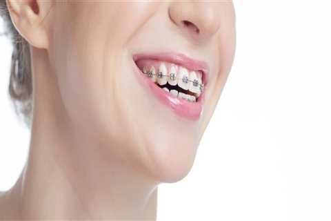 Get That Dream Smile With Orthodontics Services In Austin