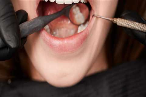 Getting a Second Opinion from a Dentist in Chandler, Arizona