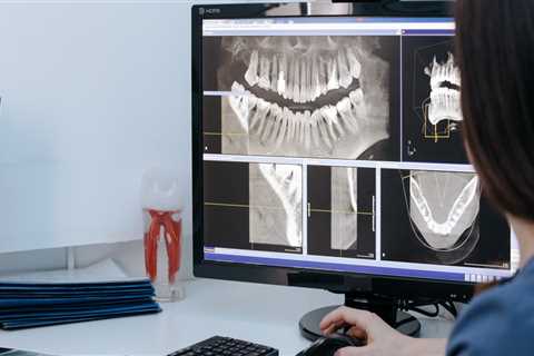 Exploring The Role Of Sedation Dentistry In Medical Imaging: Austin, TX's Latest Advancements