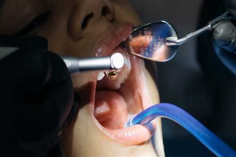 Why Should You Consider Dental Implants For Your Child? Insights From Round Rock Pediatric Dentists