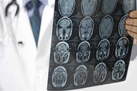 The Importance Of Early Neuro Diagnosis In The Virgin Islands: Expert Opinion From A Health..