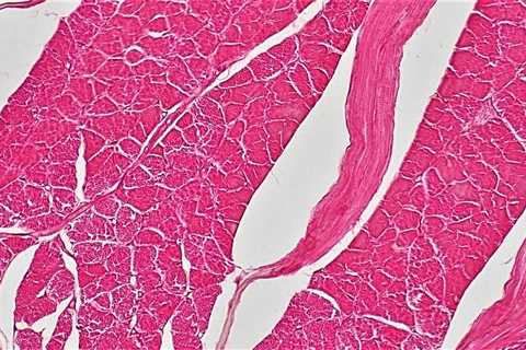 Cytokinetics Stops ALS Program After Analysis Finds No Evidence of Effect