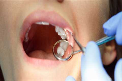 What is the Average Cost of Invisalign Treatment at a Dentist in Fairhope, Alabama?