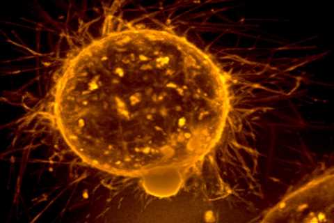 Quest Expands in Cancer Testing With $300M Haystack Oncology Acquisition