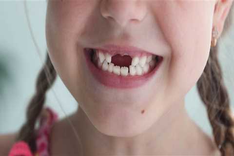 Bright Smiles Ahead: The Best Teeth Whitening Options For Kids In Summerville, SC