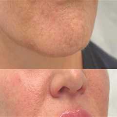 Why Medical Professional Networking Is Key To Growing Medical Spa Facial Treatments In Jacksonville