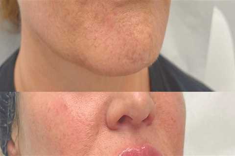 Why Medical Professional Networking Is Key To Growing Medical Spa Facial Treatments In Jacksonville