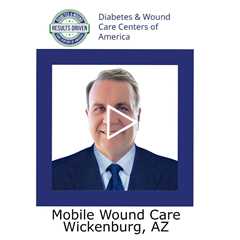 Mobile Wound Care Wickenburg AZ - Wickenburg Diabetes and Wound Care Center